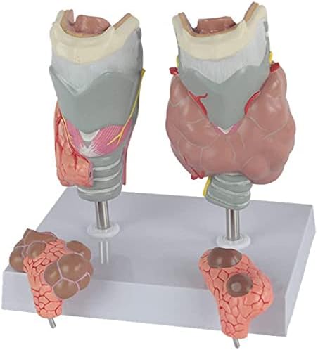 RRGJ Oktatási Modell, Pajzsmirigy Patológia Modell Nagyított Emberi Pajzsmirigy Beteg Anatómiai Modell Emberi Szerv Anatómiai